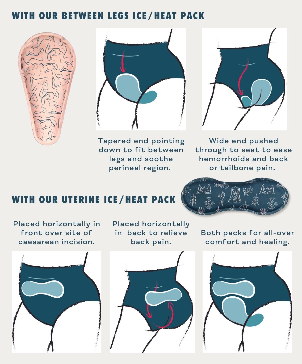Fourthwear usage chart with Between Legs and Uterine Ice/Heat Packs